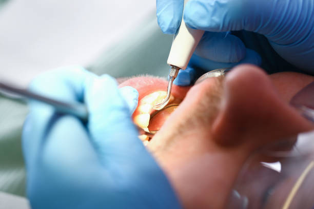 Best Emergency Tooth Extraction in Goldsboro, NC